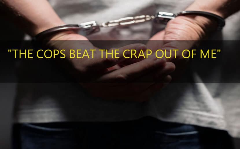 The Cops Beat the Crap Out of Me